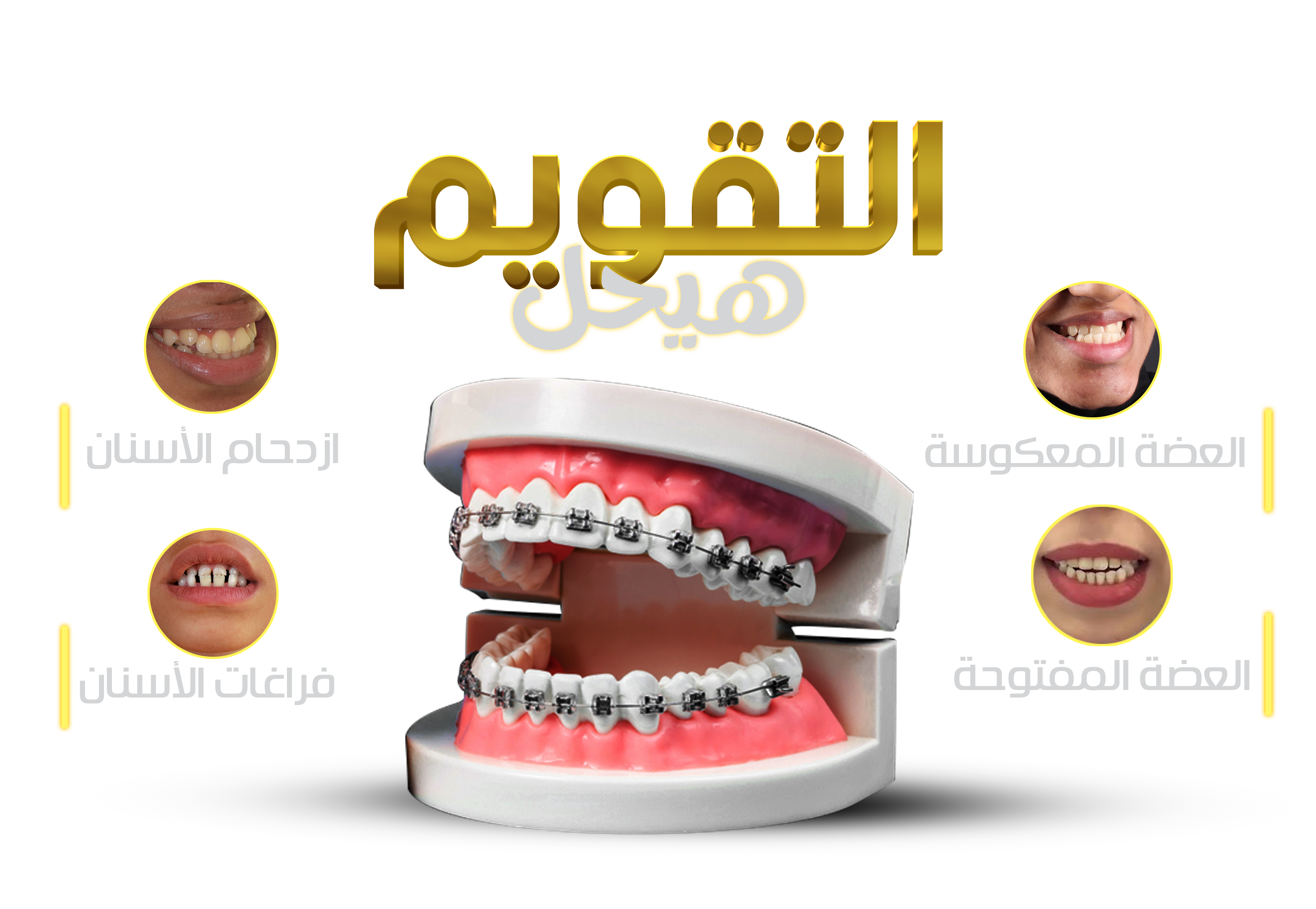 استخدامات تقويم الاسنان
