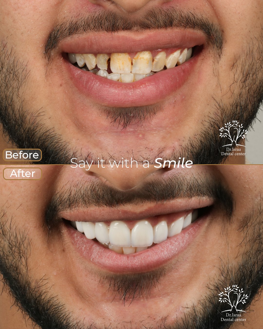 الفينير 9 male 2 1