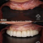 hemat mostafa 2 inplant