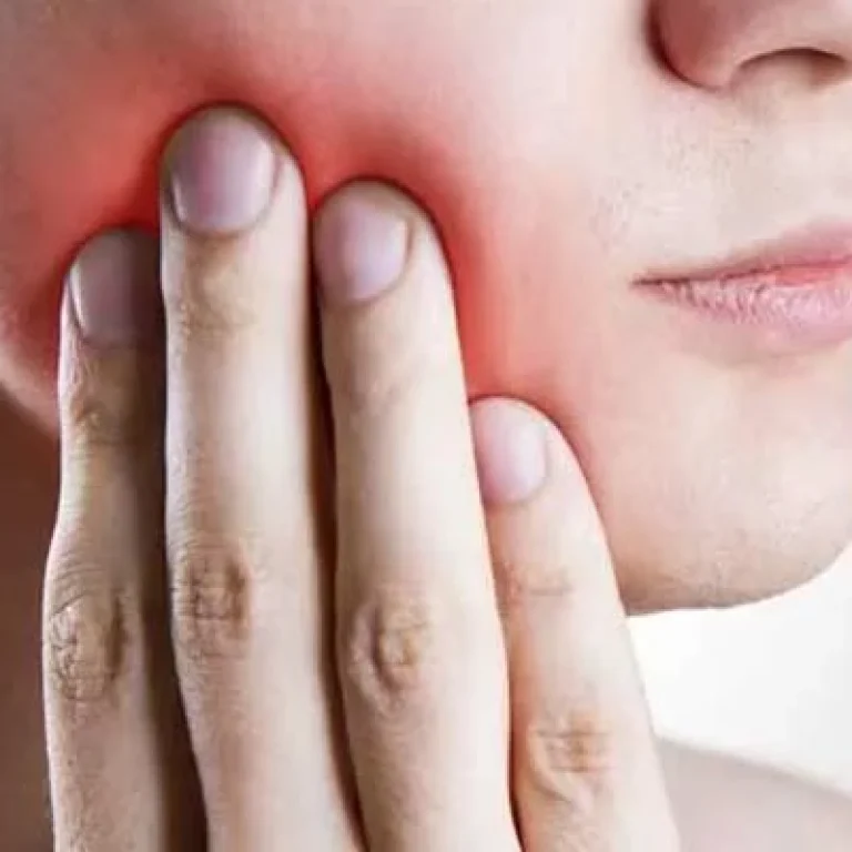 اعراض خراج الضرس