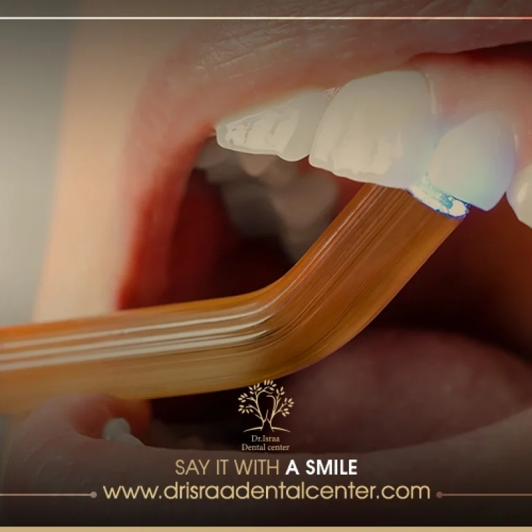 الحشوات التجميلية