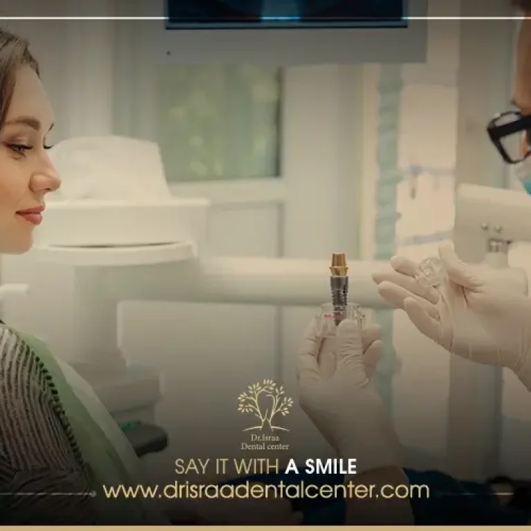 الفرق بين تركيبات الاسنان