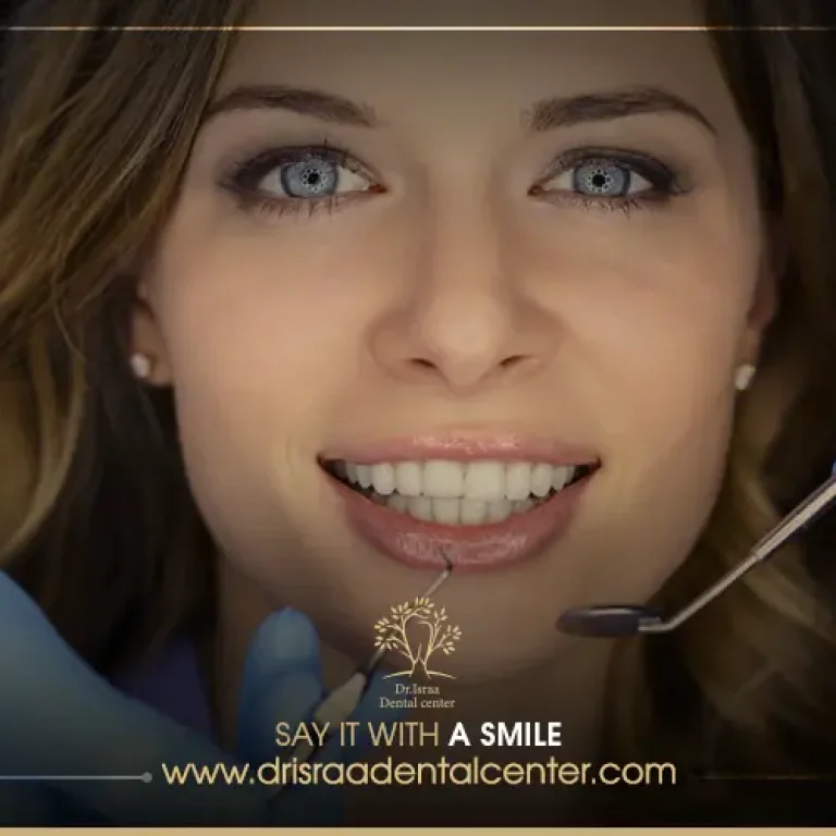 انواع تبييض الاسنان واسعارها