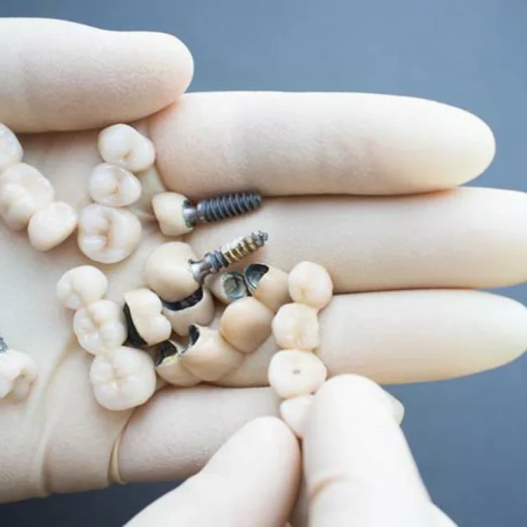 انواع طربوش الاسنان