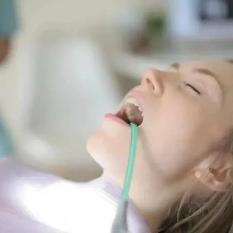 علاج خراج الضرس