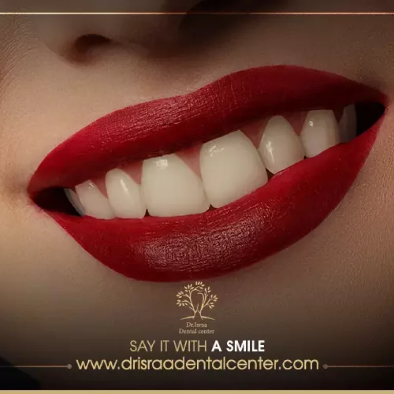 هوليود سمايل المتحركة